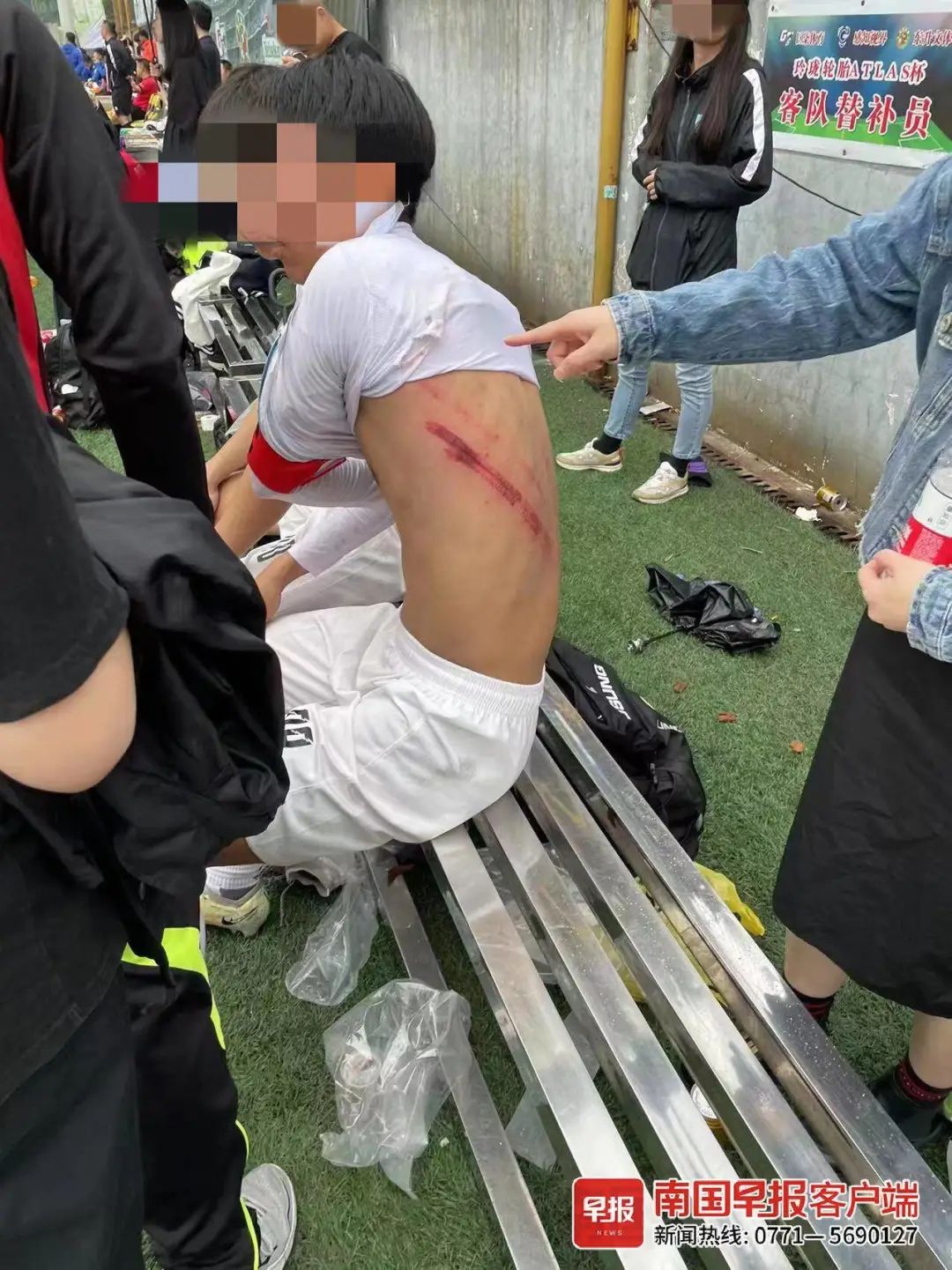 开云体育中国-比赛中球员受伤,影响球队表现